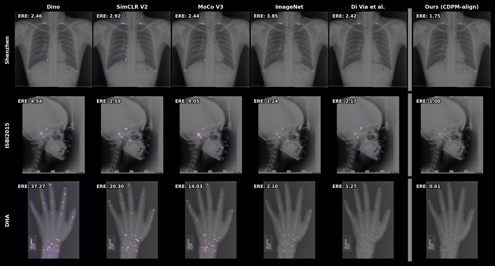 Predicted heatmap overlays at 10 shots on Shenzhen, ISBI2015 and DHA for several pretraining methods; CDPM-Align gives the tightest unimodal heatmaps