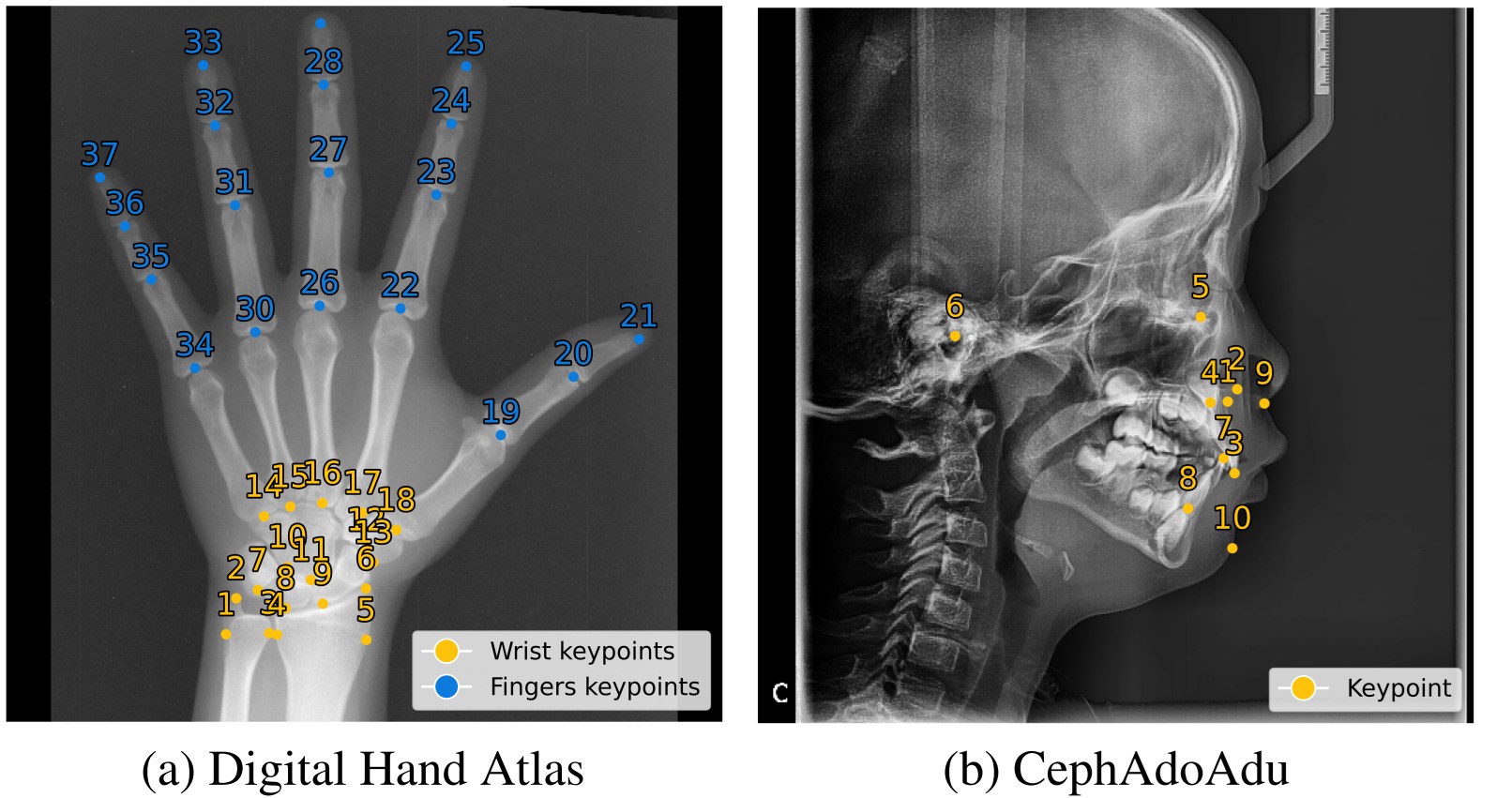 Digital Hand Atlas (37 landmarks) and CephAdoAdu (10 landmarks) X-rays with numbered ground-truth keypoints