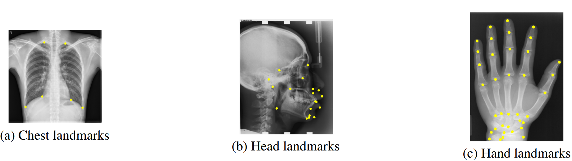 Landmarks on the three datasets